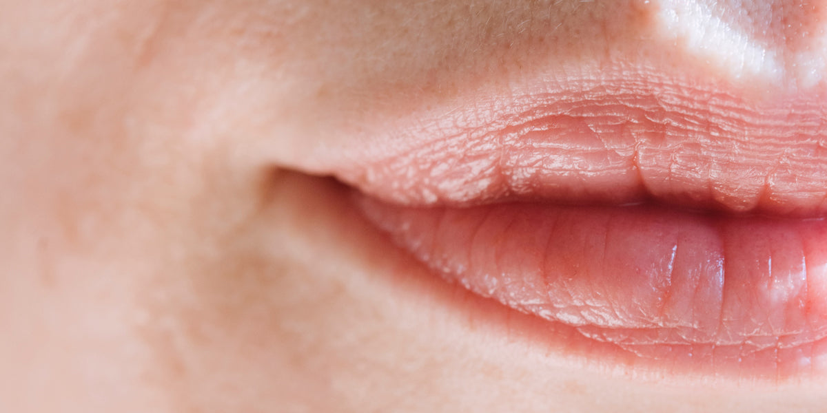 Carnose o sottili: qual è la forma delle labbra perfette?