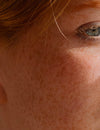 Iperpigmentazione della pelle: consigli e trattamenti efficaci