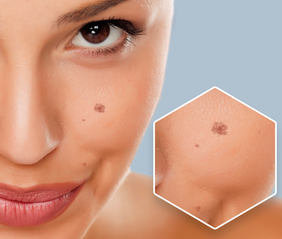 NO-SPOT siero antimacchia 2 ml