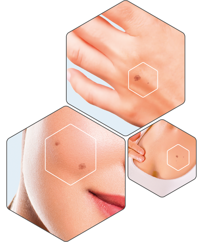 NO-SPOT siero antimacchia 2 ml