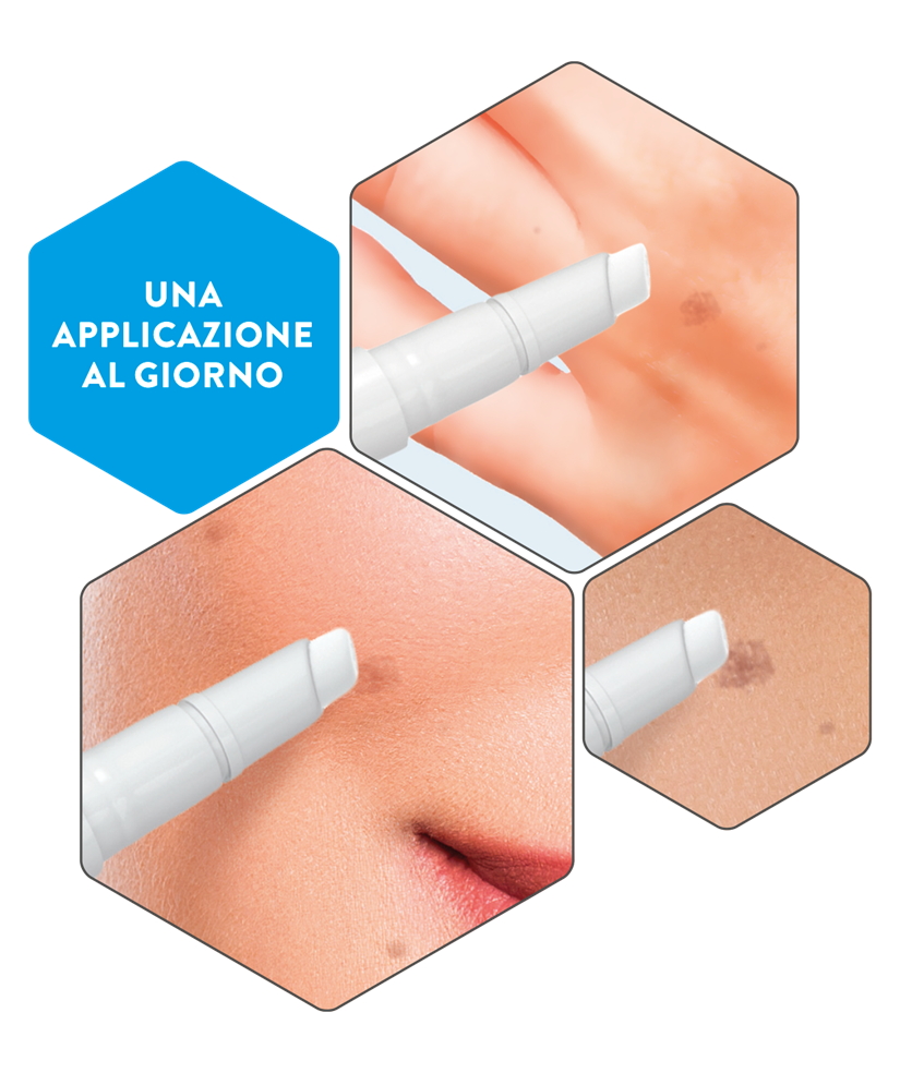 NO-SPOT siero antimacchia 2 ml